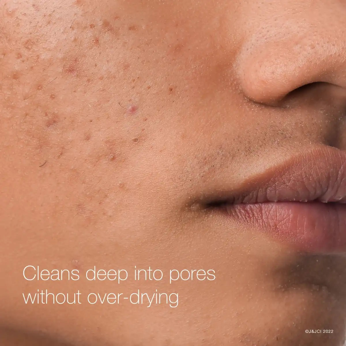 neutrogenamall.us.com